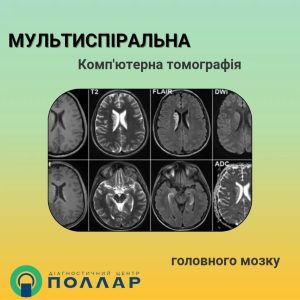 Діагностичний центр Поллар Хмельницький 9