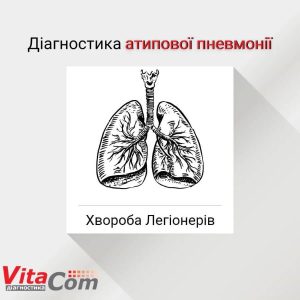 Діагностичний центр Vitacom Рівне 4